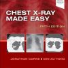 Chest X-Ray Made Easy, 5th edition (PDF)