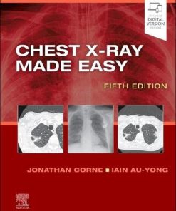 Chest X-Ray Made Easy, 5th edition (PDF)