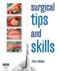 Surgical Tips and Skills