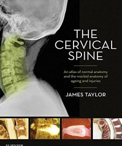 The Cervical Spine: An atlas of normal anatomy and the morbid anatomy of ageing and injuries, 1e (ePUB)