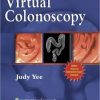 Virtual Colonoscopy