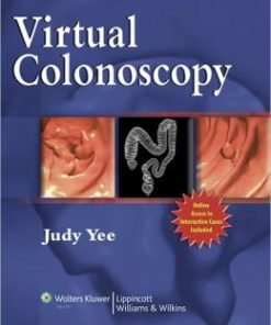 Virtual Colonoscopy