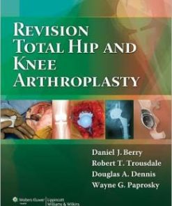 Revision Total Hip and Knee Arthroplasty (PDF)