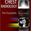 Chest Radiology: The Essentials, 2nd Edition (PDF)