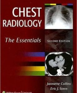 Chest Radiology: The Essentials, 2nd Edition (PDF)