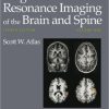 Magnetic Resonance Imaging of the Brain and Spine, 4th Edition (PDF)