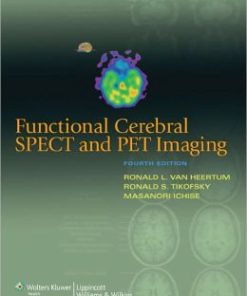 Functional Cerebral SPECT and PET Imaging, 4th Edition (PDF)