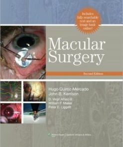 Macular Surgery, 2nd Edition (PDF)