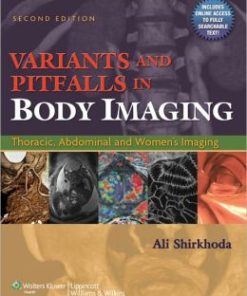 Variants and Pitfalls in Body Imaging: Thoracic, Abdominal and Women’s Imaging, 2nd Edition (PDF)