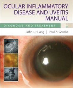 Ocular Inflammatory Disease and Uveitis Manual: Diagnosis and Treatment