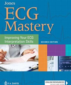 ECG Mastery: Improving Your ECG Interpretation Skills, 2nd edition (PDF)