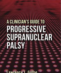 A Clinician’s Guide to Progressive Supranuclear Palsy (PDF)