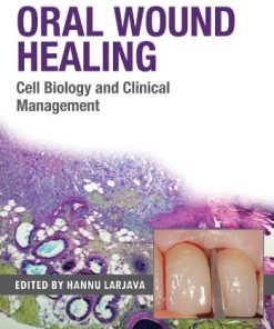 Oral Wound Healing: Cell Biology and Clinical Management (PDF)