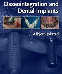 Osseointegration and Dental Implants (PDF)