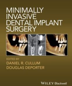 Minimally Invasive Dental Implant Surgery