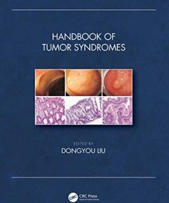 Handbook of Tumor Syndromes (PDF)