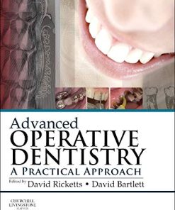 Advanced Operative Dentistry: A Practical Approach (PDF)