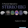 A Practical Approach to Stereo EEG (PDF)