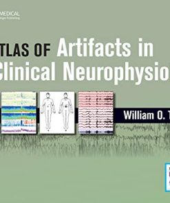 Atlas of Artifacts in Clinical Neurophysiology (PDF)