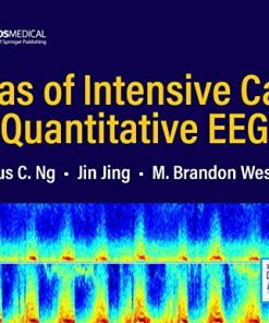 Atlas of Intensive Care Quantitative EEG (PDF)