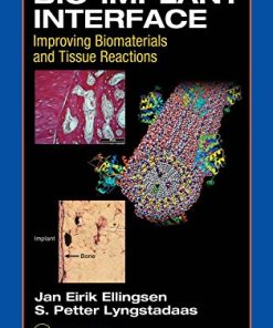 Bio-Implant Interface: Improving Biomaterials and Tissue Reactions (PDF)