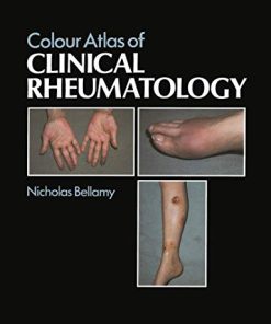 Colour Atlas of Clinical Rheumatology (PDF)