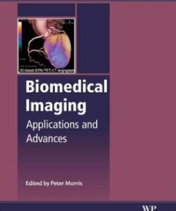 Biomedical Imaging: Applications and Advances