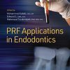 Platelet Rich Fibrin PRF Applications in Endodontics (PDF)