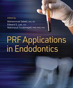 Platelet Rich Fibrin PRF Applications in Endodontics (PDF)