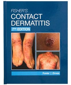 Fisher’s Contact Dermatitis, 7th Edition (ePub+Converted PDF)