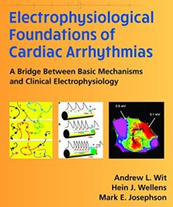 Electrophysiological Foundations of Cardiac Arrhythmias: A Bridge Between Basic Mechanisms and Clinical Electrophysiology (EPUB)