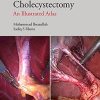 Safe Laparoscopic Cholecystectomy: An Illustrated Atlas (PDF)