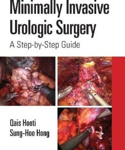 Minimally Invasive Urologic Surgery: A Step-by-Step Guide (PDF)