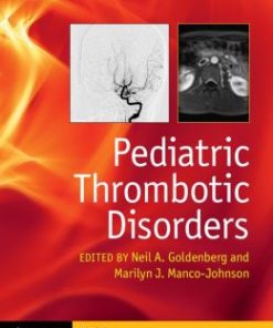 Pediatric Thrombotic Disorders