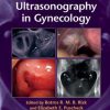 Ultrasonography in Gynecology