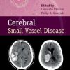 Cerebral Small Vessel Disease