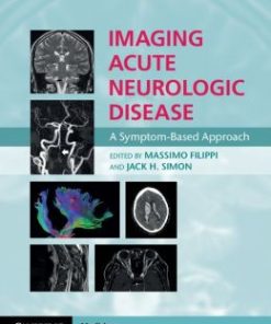 Imaging Acute Neurologic Disease: A Symptom-Based Approach (PDF)