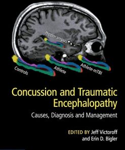 Concussion and Traumatic Encephalopathy: Causes, Diagnosis and Management (PDF)