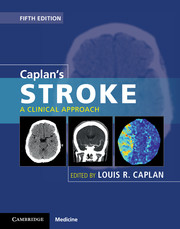 Caplan’s Stroke A Clinical Approach, 5th Edition (Retail PDF)