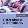 Heart Disease and Pregnancy, 2nd Edition