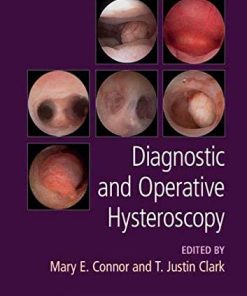 Diagnostic and Operative Hysteroscopy (ePub+Converted PDF)