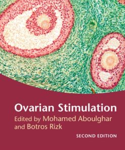 Ovarian Stimulation, 2nd Edition (PDF)