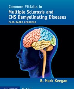 Common Pitfalls in Multiple Sclerosis and CNS Demyelinating Diseases: Case-Based Learning