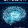 Mood Disorders: Brain Imaging and Therapeutic Implications (PDF)