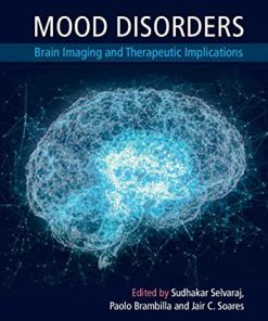 Mood Disorders: Brain Imaging and Therapeutic Implications (PDF)