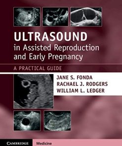 Ultrasound in Assisted Reproduction and Early Pregnancy: A Practical Guide (PDF)