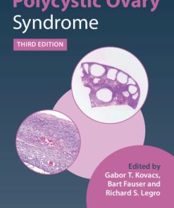 Polycystic Ovary Syndrome, 3rd edition (PDF)