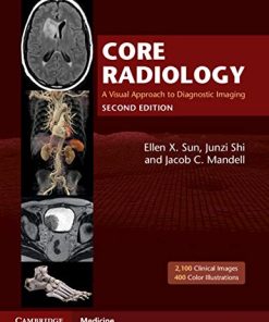 Core Radiology: A Visual Approach to Diagnostic Imaging, 2nd Edition (PDF)