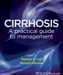 Cirrhosis: A Practical Guide to Management