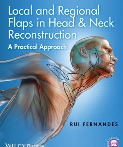 Local and Regional Flaps in Head and Neck Reconstruction: A Practical Approach (Videos+PPT)